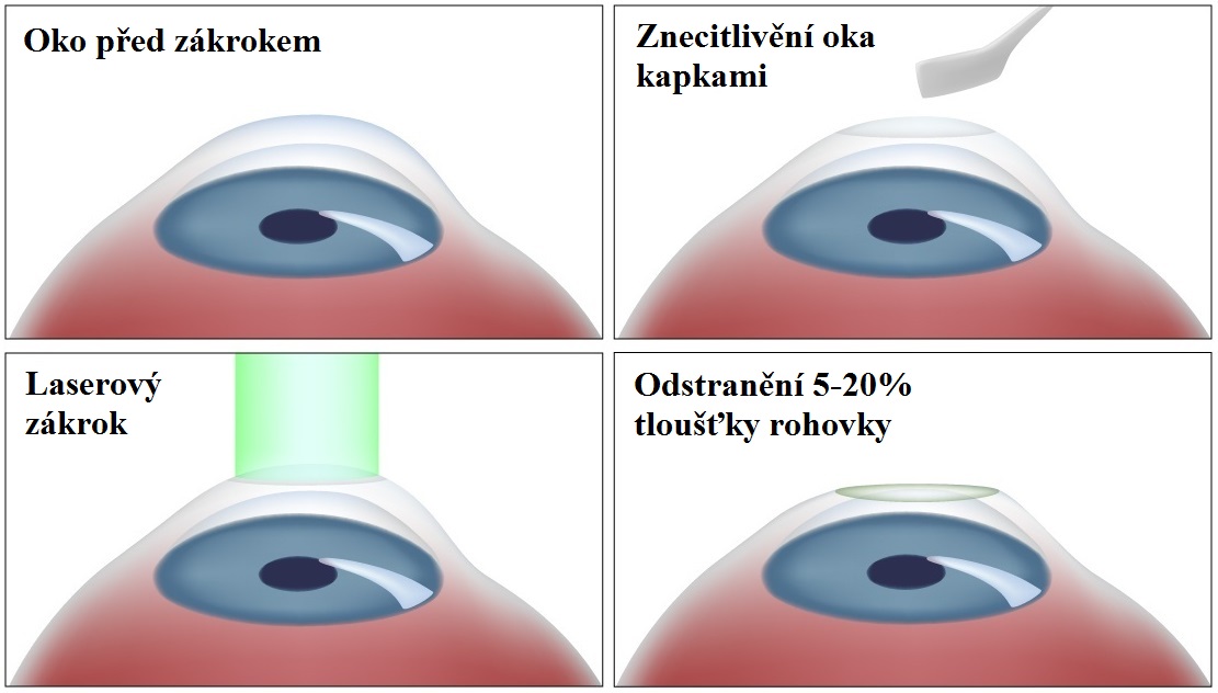 Co se děje po operací?